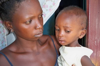 A woman with a malnourished child in Conakry.