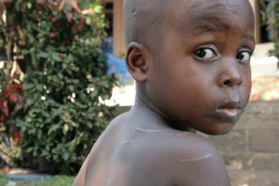 Côte d'Ivoire: A child who was wounded in a machete attack in mid-April 2011.