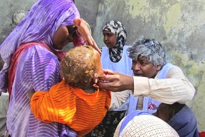 Dr Unni Karunakara examining a child in Somalia.