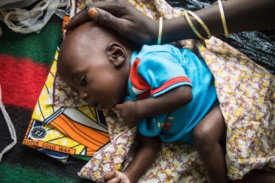 Une mère caresse la tête de son bébé mal nourri au centre pour la mère et l'enfant de la ville de Diffa, au Niger. ,