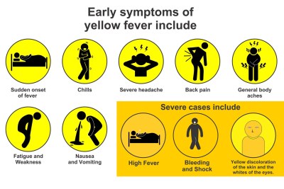 Yellow fever signs and symptoms (file photo).