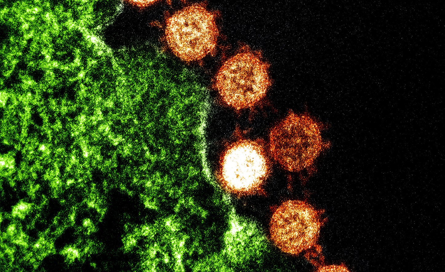 Africa Virus Outbreak Impacts Africans at Home and Abroad